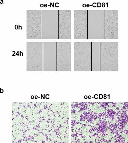 Figure 6. CD81 overexpression accelerated the cell migration after LPS treatment.