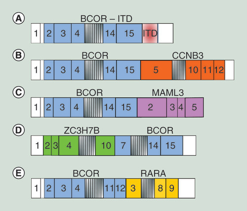 Figure 3. Schematic representation of different BCOR alterations, including internal tandem duplications and chimeric fusion transcripts.The numbers inside the boxes represent the exons, while open boxes indicate UTR regions. (A) ITD–BCOR, (B) BCOR–CCNB3, (C) BCOR–MAML3, (D) ZC3H7B–BCOR and (E) BCOR–RARA.ITD: Internal tandem duplication.