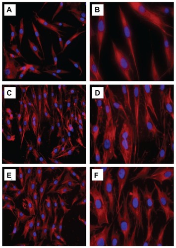 Figure 6 Actin cytoskeletal organization (red, labelled with rhodamine-phalloidin, counterstained with DAPI for nuclei in blue) of MG-63 cells after incubation with n-HA1 and n-HA2 for 5 days: (A and B) control cells; (C and D) n-HA1; (E and F) n-HA2. Cells with the n-HA1 material tended to have a more organized actin cytoskeleton.Abbreviation: n-HA, nanohydroxyapatite.