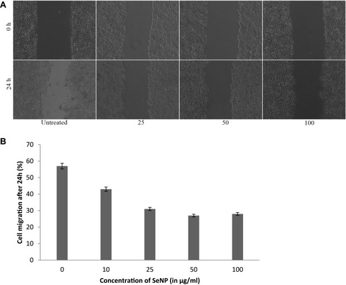 Figure 11 Measurement of cell migration by in vitro cell migration assay. HeLa cells were grown in 6 well plates to 90% confluency. A scratch was made in the center of the well using a sterile 10 μL tip and the scratch width was measured at 0 h and 24 h time point using ImageJ software. Images were captured with a Thermo Evos inverted microscope at 4X magnification and percentage cell migration was measured. (A) Images of scratches made, after 0 h and 24 h treatment at different concentrations of SeNp (in μg/mL). (B) Percentage of cell migration after treatment with different concentrations of SeNP was calculated after measuring the scratch width at 24 h with respect to 0h timepoint.