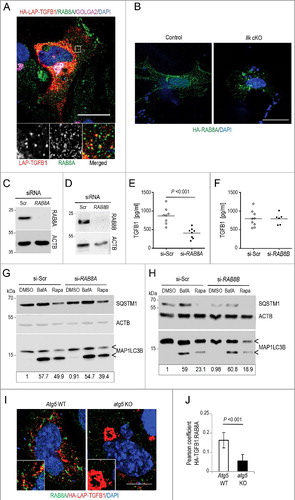 Figure 9. Transport of latent TGFB1 to the cell surface requires RAB8A-mediated secretion. (A) Immunofluorescence analysis of human Wi26 fibroblasts expressing HA-LAP-TGFB1 (red), stained for endogenous RAB8A (green) and GOLGA2 (magenta) identified colocalization of HA-LAP with RAB8A at Golgi-derived autophagosomal intermediates (yellow in merged inset). Scale bar: 10 μm. (B) Immunofluorescence analysis of murine control and Ilk cKO fibroblasts, transfected with HA-tagged RAB8A (green; DAPI-stained nuclei appear blue) showed relocalization of RAB8A to perinuclear aggregates. Scale bar: 10 μm. (C and D) Immunoblots illustrating knockdown efficiency of RAB8A (C) and RAB8B (D) in comparison to control (si-Scr). ACTB levels were used to indicate comparable loading. (E and F) Secreted TGFB1 levels were significantly reduced upon knockdown of RAB8A (P<0.001) (E); whereas no change in TGFB1 secretion was detected upon knockdown of RAB8B (F). Each symbol represents one independent transfectant. (G and H) Autophagy was analyzed in human Wi26 fibroblasts following treatment either with DMSO, or with 100 nM BafA, or with 20 μg/ml rapamycin (Rapa) for 4 h. The upper and lower ‘<’ symbols in the immunoblots indicate the position of the MAP1LC3B-I and -II variants, respectively. Autophagy was visualized by the presence of MAP1LC3-II and SQSTM1 bands in immunoblots. Depletion of RAB8A (G) and of RAB8B (H) did not affect basal or stimulated autophagy. Data are representative of 3 experiments. Signal intensities were quantified densitometrically and the ratio of MAP1LC3-II to ACTB is presented below the blots. (I) Immunofluorescence analysis of MEFs derived from atg5 KO or Atg5 WT animals expressing HA-LAP-TGFB1 (red) and stained for endogenous RAB8A (green) identified partial colocalization of HA-LAP with RAB8A at Golgi-derived autophagosomal intermediates (yellow in merged inset), which is not observed in atg5 KO cells. Scale bar: 5 μm. (J) The images of 20 Atg5 WT and 26 atg5 KO cells were used to determine the Pearson correlation coefficient, which reflects the extent of colocalization of TGFB1 with RAB8A (LAP and RAB8A). Values of about 0.15 confirmed selective colocalization.