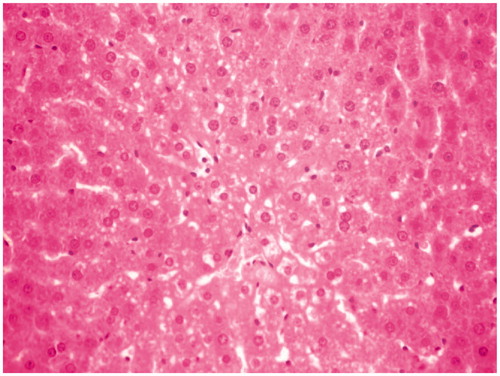 Figure 6. CCl4 + silymarin-100 mg/kg-treated group rat liver section showing less disarrangement and degeneration of hepatocytes.
