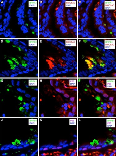Figure 6 Localization of BPIFA1 and BPIFB1 expression in lung tissue by double immunofluorescence staining.
