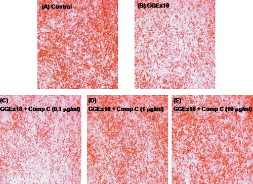 Figure 5.  Compound C increases GGEx18-induced decreases in triglyceride droplets in C2C12 cells. C2C12 cells were differentiated as described in the Materials and Methods section and triglycerides were stained with oil red O. Differentiated cells treated with (A) DMSO, (B) 10 μg/mL GGEx18, (C) 10 μg/mL GGEx18 plus 0.1 μM compound C, (D) GGEx18 plus 1 μM compound C, and (E) GGEx18 plus 10 μM compound C. Comp C, compound C.