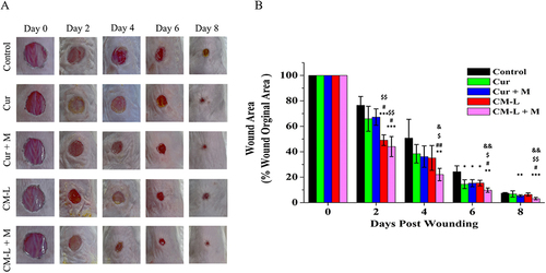Figure 11 In vivo wound healing effect of curcumin-loaded micelle formulations and microcurrent cloth. (A) Effect of the curcumin and loaded micelle formulations with and without microcurrent on wound healing from day 0 to day 8. Images were taken every 2 days during treatment. (B) Area percentage of mouse wound healing. (mean ± SD; *: P < 0.05, **: P< 0.01, ***: P < 0.001 compared with the control; #: P <0.05, ##: P<0.01 compared with Cur; $ < 0.05, $$< 0.01 compared with Cur + M; &: P < 0.05, && <0.01 compared with CM-L.