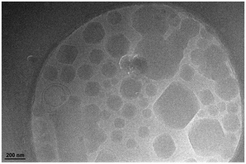 Figure 2 Cryogenic transmission electron microscopy image of ibuprofen-loaded cubic nanoparticles.