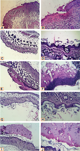 Figure 2 Histopathological examination of non infected wound before and after treatment with L. plantarum and or L. inermis. (A and B) Uninfected group. Sections showed a shallow ulcerative lesion with minimal epidermal and dermal florid inflammatory reaction. All other structures of the skin keep a normal morpho-histological appearance. (C and D) Lactiplantibacillus cell group. The skin specimens revealed normal morpho-histological structures; however mild superficial contamination was seen, but without any significant pathologic reaction. (E and F) that replaced large parts of the epidermis was seen. The ulcerated tissue is replaced by suppurative inflammatory exudate with a predominance of neutrophils and secondary saprophytic infection. (G and H) Lawsonia Group. Examined sections revealed a mild superficial exfoliative reaction with secondary contamination. (I and J) Combination group. Although clear ulcerative lesions were not seen, a peculiar exudative epidermal reaction was seen. Such exudate was seen covering the epidermis and contained a moderate number of neutrophils and the saprophytic contaminant. An epidermal exfoliative reaction was also seen (H&E X400, zoomed section X30).
