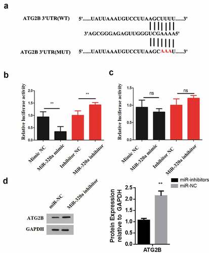 Figure 5. ATG2B expression is upregulated by crocin. (a) The illustration of the complementary sequence between miR-320a and ATG2B. (b) The luciferase activity in wild-type luciferase constructs. (c) The luciferase activity in mutant-type luciferase constructs. (d) ATG2B expression following miR-320a inhibitor transfection. NS, non-significant, *P < 0.05, **P < 0.01, ***P < 0.001 versus the control group