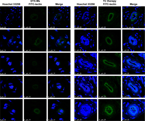 Figure S4 FITC-lectin perfusion in tumors treated with DTX-Ms and TC therapy marked microvascular integrality.Notes: Five random visions were pictured from two tumor tissues. Scale bar: 10 µm (left) and 25 µm (right).Abbreviations: DTX-Ms, docetaxel micelles; TC therapy, two-stage combination therapy.