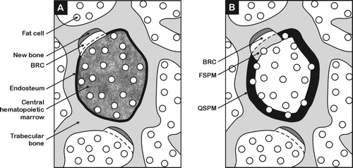 Figure 1. Schematic diagrams (not to scale) depict trabecular marrow cavities that in reality are usually interconnecting. Sub-figure (A) names the anatomical parts of a marrow cavity and shows the partitioned hematopoietic targets for leukemia, consisting of the endosteum and central hematopoietic marrow and (B) shows the partitioned peripheral marrow targets for bone cancer consisting of quiescent surface peripheral marrow (QSPM) and forming surface peripheral marrow (FSPM): the latter target could include the bone remodelling compartment (BRC).