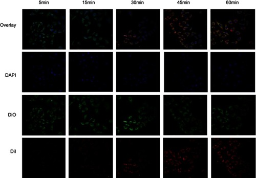 Figure S3 Cellular uptake of nanoparticles within one hour. Scale bar: 50 μm