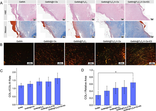 Figure 8 (A) Histomorphological evaluation of wound regeneration. (B) Image of Sirius red -stained tissue in wound healing area. (C) COL-I/COL-III area ratio in the wound-healing region. (D) COL-I contents in the wound-healing region, the scale length is 200 μm (H&E and Masson) and 100 μm (Sirius red). *P < 0.05, n=3.