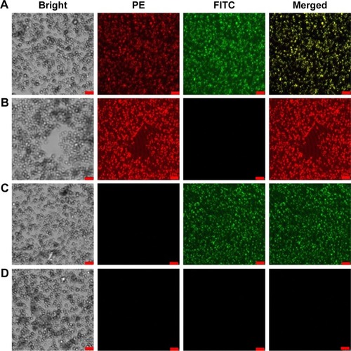 Figure 3 Confocal microscopic images of (A) DNCs, (B) VNCs, (C) PNCs, and (D) NNCs in bright field, FITC, PE, and merged channels (scale =2.5 µm), and the merged yellow signals indicate the presence of VEGFR2 and p53 in DNCs.Notes: DNCs, dual-targeted gold nanoshelled poly(lactic-co-glycolic acid) nanocapsules carrying anti-vascular endothelial growth factor receptor type 2 antibody and anti-p53 antibody; NNCs, non-targeted gold nanoshelled poly(lactic-co-glycolic acid) nanocapsules; PNCs, single-targeted gold nanoshelled poly(lactic-co-glycolic acid) nanocapsules carrying anti-p53 antibody; VNCs, single-targeted gold nanoshelled poly(lactic-co-glycolic acid) nanocapsules carrying anti-vascular endothelial growth factor receptor type 2 antibody.Abbreviations: FITC, fluorescein isothiocyanate; PE, phycoerythrin;