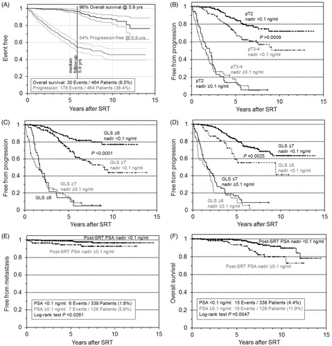 Figure 1. Kaplan–Meier curves of outcome after salvage radiotherapy for post-prostatectomy recurrent prostate cancer. Progression and overall survival in the entire cohort (N= 464), with 95% confidence intervals (A); stages pT2 versus pT3-4 (B); Gleason score GLS ≤6 versus GLS 7–10 (C); GLS ≤7 versus GLS 8–10 (D); metastatic disease (E); overall survival (F). In B–F, patients were stratified by the post-SRT PSA nadir.