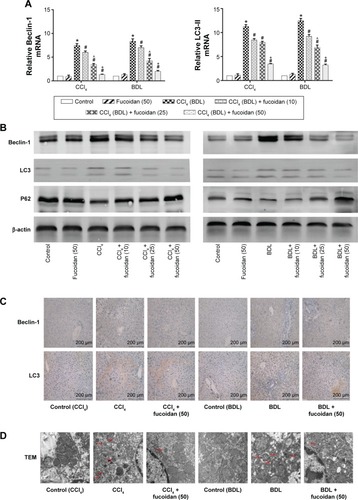 Figure 3 Effect of fucoidan on the process of autophagy in liver fibrosis.