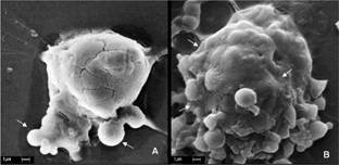 Figure 3 Scanning electron micrography of macrophage (P388-D1 cells) exposed to dye loaded nanoparticle. (A) 30 min incubation in adhesion process; (B) 2 hr of incubation; (→) nanoparticle inside the cell in a phagocytose process. Scale barr 1 μ m.