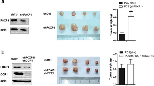 Figure 5. Downregulation of FOXP1 promotes the tumorigenesis via CCR1 in xenograft mouse model.(a) Left panel shows the representative Western Blot image of PC9 cells treated with shFOXP1. Actin serves as the loading control. Middle panel shows the representative picture of tumors induced by PC9 cells treated with shCtrl or shFOXP1. Bar charts in the right panel show the weight of tumors generated by PC9 cells treated with shCtrl or shFOXP1. (b) Left panel shows the representative Western Blot image of PC9 cells treated with shFOXP1+ shCCR1. Actin serves as the loading control. Middle panel shows the picture of tumors induced by PC9 cells treated with shCtrl or shFOXP1+ shCCR1. Bar charts in the right panel show the weight of tumors generated by PC9 cells treated with shCtrl or shFOXP1+ shCCR1. * p < 0.05.