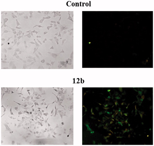 Figure 2. Detection of apoptosis induced by compound 12b in non-small cell lung cancer cell line A549 using Annexin V-FITC assay. Cells were visualised by fluorescence microscope at 40× magnification before and after treatment with the concentration of 2 × IC50 for 48 h. PI staining was used as a nuclear marker. Shown here are bright-field images (left micrographs) and late apoptotic/primary necrotic cells (right micrographs).