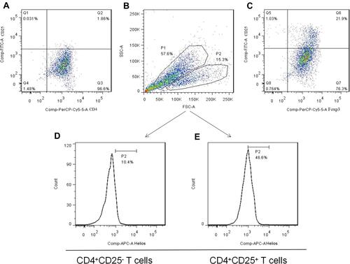 Figure 4 The generation of induced Tregs. (A) Freshly isolated CD4+CD25− T cells from PEMCs of an NSCLC patient by magnetic bead sorting. (B and C) CD4+CD25+Foxp3+ Tregs were produced by cytokine stimulation. (D and E) Helios expression in induced Tregs and non-Tregs, respectively.