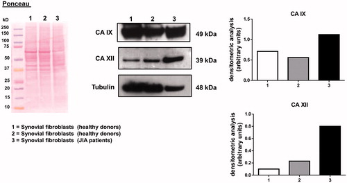 Figure 3. Western blotting detection of CA IX and CA XII in synovial fibroblasts from healthy donors and from JIA patients. Tubulin expression and Ponceau staining are used as a control for protein loading. Histograms on the right report band densitometry.