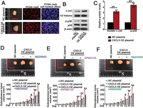 Figure 5. Forced overexpression of CXCL5 promotes the growth of B-CPAP xenografted tumors via activation of JNK or p38 pathway.BCPAP cells were resuspended in 0.1 mL serum-free RPMI medium, mixed with 0.1 mL Metrigel and then injected into the axillary skin of nude mice. (a) The xenografted tumors were isolated and photographed on day 28 post the injection of cancer cells (left column). Immunofluorescence assay using PCNA antibody was conducted to probe PCNA-positive cells within the tumors (bars, 50 μm; middle and right columns). (b) The levels of nuclear c-Jun and phosphorylated or total p38 were determined with western blot analysis, and (c) calculated by comparing to H3 histone or β-actin. (d-f) Nude mice injected with CXCL5 OE BCPAP cells were given CXCR2 antagonist SB225002 (intraperitoneal injection of 10 mg/kg for three times a week), JNK pathway inhibitor SP600125 (intraperitoneal injection of 5 mg/kg for three times a week) or p38 inhibitor SB203580 (subcutaneous injection of 4 mg/kg for five times a week) for four weeks. The xenografted tumors were isolated and photographed on day 28 post the injection of cancer cells. The tumor volume was measured every three day before sacrificing on day 28. All data were expressed in mean ± standard error (n = 6). **P < 0.01; *P < 0.05. CXCL5, C-X-C motif chemokine ligand 5; PCNA, anti-proliferating cell nuclear antigen; OE, overexpression