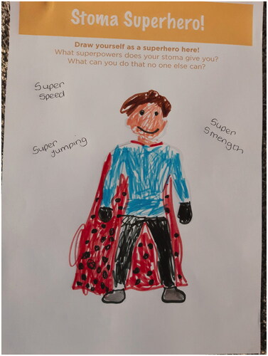 Figure 3. ‘Stoma Superhero’ An example of engagement with children and young people.