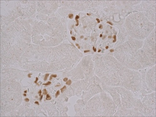 Figure 1 WT-1 stained glomeruli. Sections from kidney tissue s were stained with primary WT-1 (Wilms Tumor protein) antibody (Ab89001, Abcam, Cambridge, MA, USA) using ABC Kit (PV-9001, Zhongshan Goldenbridge, Beijing, China) that functions as podocyte marker 400×.