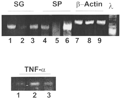 Figure 7. Effect of pentoxifylline (PTX) on expression levels of Na+-glucose (SG), Na+-phosphate (SP), TNF-α, and β-actin. Total RNAs were isolated from the cortex of kidneys subjected to ischemia/reperfusion with or without PTX pretreatment. Lane 1, 4, 7: control kidneys; Lane 2, 5, 8: ischemia; Lane 3, 6, 9; ischemia + PTX.