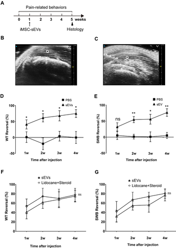 Figure 2 Analgesic Effect of iMSC-sEVs on Rat Tendinopathy Model. (A) Diagram showing timing for the model establishment and iMSC-sEVs treatment. Pain-related behaviors were assessed once per week for 5 weeks and histopathological changes were evaluated at 5 weeks after model establishment. (B) Ultrasonogram of rat’s right leg (anterior view) around the quadriceps tendon showing quadriceps (Q) and femur (F). (C) Ultrasonogram showing the relative position of needle (white triangles) used to inject 4% carrageenan (100 μL bolus) solution around the quadriceps tendon. Asterisks (white) in (B and C) indicate the position of the quadriceps tendon. Pain-related behaviors were performed by using PWT (D) and SWB (E) reversal (%) up to 4 weeks after tendinopathy model establishment. PWT (F) and SWB (G) reversal (%) up to 4 weeks after tendinopathy model establishment. N = 5 rats for each group. SWB = static weight bearing; PWT = hind-paw withdrawal threshold; Data are presented as mean ± SD. *P < 0.05. **P < 0.01. ns indicates no significant difference.