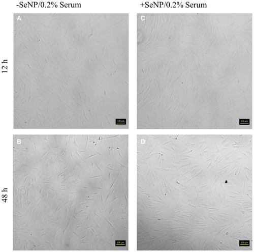 Figure 6 Phase contrast images for human dermal fibroblasts (HDFs) with 0.2% FBS-DMEM challenge at 12 and 48 hrs. 10× magnification. (A): –SeNP/12 hrs; (B) –SeNP/48 hrs; (C) +SeNP/12 hrs; (D) +SeNP/48 hrs. Scale bars = 100 microns.