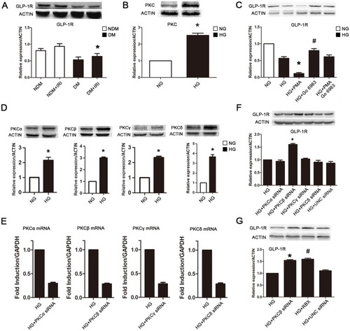 Figure 2 Overexpression of PKCβ induced by high glucose downregulated GLP-1R expression in H9C2 cells. (A) High glucose-induced downregulation of GLP-1R and impact of myocardial IRI on GLP-1R expression. *P<0.05 vs NDM group and NDM + IRI group; (B) high glucose-induced overexpression of PKC. *P<0.01 vs NG group; (C) impact of PMA and Go 6983 on GLP-1R expression in H9C2 cells. *P<0.01 vs HG group, #P<0.05 vs HG group and HG + PMA + Go6983 group; (D) high glucose-induced overexpression of PKCα, -β, -γ and –δ. *P<0.01 vs NG group; (E) transfection efficiency of PKCα (70.3±2.1%), -β (71.5±3.2%), -γ (68.3±2.6%) and –δ (66.4±3.1%) siRNA; (F) change of GLP-1R expression by knockdown of PKCα, -β, -γ and –δ. *P<0.01 vs HG group and HG + UNC siRNA group; (G) impact of RBX and PKCβ siRNA on GLP-1R expression in H9C2 cells, *P<0.05 vs HG group and HG + UNC siRNA group, #P<0.05 vs HG + RBX group.