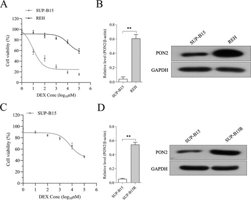 Figure 2. The expression of PON2 in REH and SUP-B15 cell lines. (a) Human ALL cell lines REH and SUP-B15 were treated with DEX (from 0.001 to 100 μM) for 24 hours. Cell viability as determined by CCK-8 assay. (b) The mRNA level and protein expression of PON2 in REH and SUP-B15 was measured by qRT-PCR and Western blot, respectively. (c) SUP-B15 was treated with increasing concentrations (from 1 nM to 5 µM) of DEX for 90 days following 14 days of culture in the absence of DEX. Cell viability as determined by CCK-8 assay. (d) The mRNA level and protein expression of PON2 in SUP-B15 and SUP-B15R was measured by qRT-PCR and Western blot, respectively. **P < .01 compared with SUP-B15.