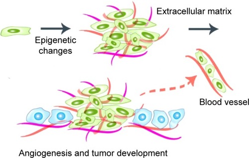 Figure 2 Epigenetic changes in tumor cells and tumor development.Note: The later stages in tumor development are supported by angiogenesis.