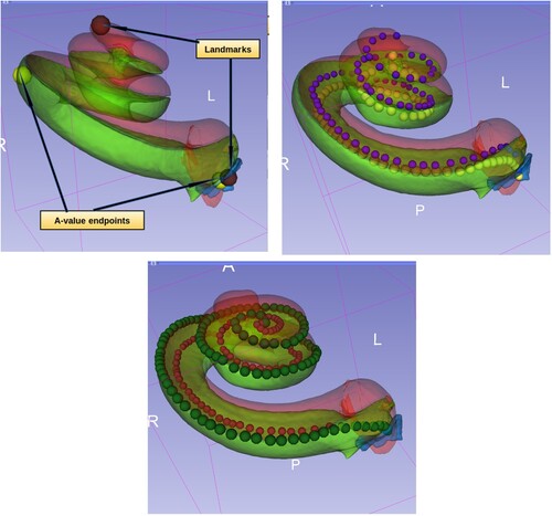 Figure 4 Top left: Cochlea landmarks in brown colour and A-value endpoints in yellow colour. Top right: The point models of scala tympani (in yellow) and scala vestibuli (in blue) central lengths. Bottom: The point models of scala tympani, the outer points in dark green colour for measuring the lateral wall length and the inner points in dark red for measuring the organ of corti length.