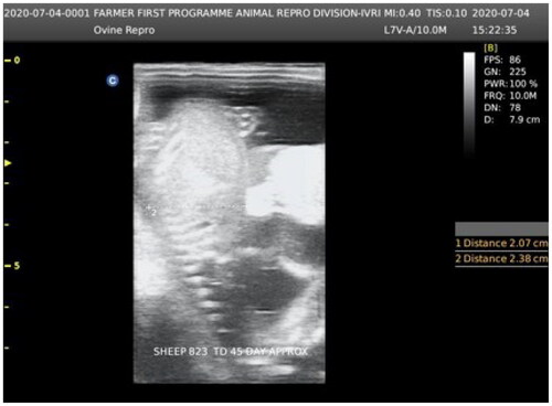 Figure 1. Fetal age determination by using (C3-A) real-time ultrasound equipment (Aeroscan-CD-5 Konica Minolta, India) having a convex transducer (C3-A).