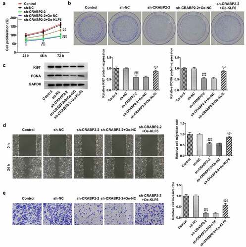 Figure 5. KLF16 overexpression reverses the effects of CRABP2 knockdown on proliferation, invasion and migration of RB cells. (a) The proliferation and (b) colon formation ability of WERI-RB1 transfected with sh-CRABP2-2 and Oe-KLF16 was analyzed by CCK-8 and colon formation assay. (c) The expression of proliferation related proteins (Ki67 and PCNA) in WERI-RB1 transfected with sh-CRABP2-2 and Oe-KLF16 was determined by Western blot. (d) The migration and (e) invasion of WERI-RB1 transfected with sh-CRABP2-2 and Oe-KLF16 was analyzed by wound healing and transwell assay. *P < 0.05, **P < 0.01 and ***P < 0.001 vs. control group. ##P < 0.01 and ###P < 0.001 vs. sh-NC group. ∆∆P < 0.01 and ∆∆∆P < 0.001 vs. sh-CRABP2-2+ Oe-NC group.