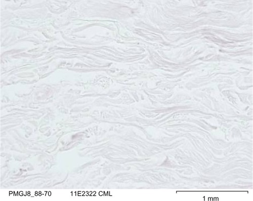 Figure 10 Carboxymethyl lysine (CML) immunostaining of Centella asiatica-treated batch stimulated with methylglyoxal on day 8.