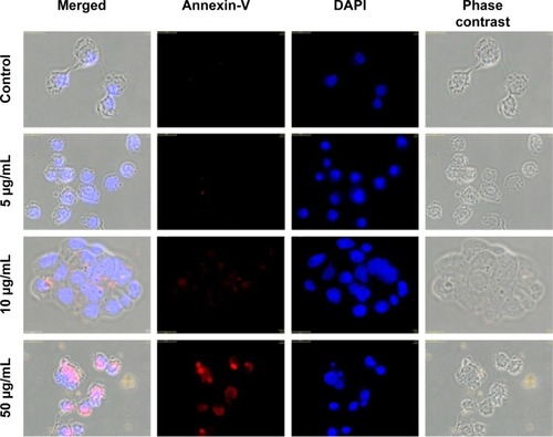 Figure 4 Detection of apoptosis using Annexin V-cy3.Notes: Control sample followed standard cell culture conditions. Test cells were treated with Alb-GNPs with different concentrations 5, 10, and 50 μg/mL, respectively and laser irradiated. Consequently, all samples were stained with annexin-cy3 for 5 minutes (RT, dark). Nucleus staining was also performed using DAPI blue-fluorescence. Control sample (no Alb-GNPs exposure, no irradiation). No red fluorescence was observed. Exposure to 5 μg/mL Alb-GNPs (1 hour, 37°C), followed by laser excitation (3 minutes, 808 nm, 2W/cm2). Red fluorescence is displayed in a reduced number of cells, granular aspect coming from limited number of PS groups exposed on the outer surface of the membrane. Exposure to 10 μg/mL Alb-GNPs (1 hour, 37°C), followed by laser excitation (3 minutes, 808 nm, 2W/cm2), increased the number of early-apoptosis entrance cells. Red fluorescence aspect is diffuse, suggesting intense PS translocation process. Exposure to 50μg/mL Alb-GNPs (1 hour, 37°C), followed by laser excitation (3 minutes, 808 nm, 2W/cm2). The majority of cells present intense, diffuse, red Cy3 fluorescence covering the entire outer surface of the membrane suggesting a highly intense pro-apoptotic effect. Magnification: 60×.Abbreviations: GNPs, gold nanoparticles; RT, room temperature; DAPI, 4′,6-diamidino-2-phenylindole; PS, phosphatidylserine; Alb, albumin.