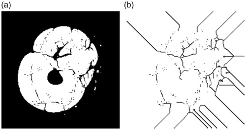 Figure 5. Backgroud skeleton extraction for vatus. (a) Before extraction; (b) After extraction.