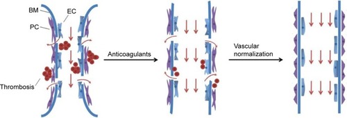 Figure 1 Strategies to enhance blood vessel perfusion and drug penetration.