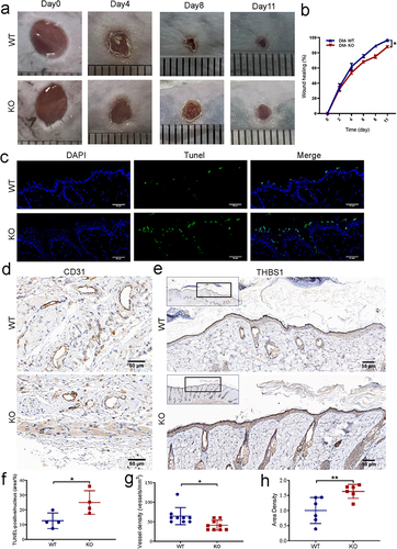 Figure 5 Effect of miR-221 knockout on wound healing in diabetes mice. Representative photomicrographs (a) and summary data (b) showing wound area changes on days 0, 4, 8, and 11 in wild type (WT) and Mir-221 knockout (KO) diabetes mice (DM). Data are described as mean ± SEM, n = 8. The TUNEL assay was conducted to examine the role of Mir-221 knockout on the apoptosis of epithelial layer at the edge of the wound (c and f). TUNEL-positive cells are shown in green while the nuclei are shown with DAPI (blue). Scale bar is 50 µm. Angiogenesis analysis based on immunohistochemistry (IHC) staining of CD31 in dorsal skin sections from DM-WT & DM-KO mice, quantified by the number of blood vessels per unit area (d and g). Scale bars, 50 μm. IHC staining of THBS1 in dorsal skin sections from DM-WT & DM-KO mice (e and h). Scale bars, 50 μm. Data are presented as mean ± SEM, n = 3–4. *P < 0.05 and **P < 0.01 for DM-WT vs DM-KO.