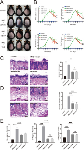 Figure 4 3-BrPA was found to reduce the psoriasiform inflammation induced by IMQ in mice. (A) The mice model of IMQ-induced psoriatic inflammation was created and topical drugs were applied. (B) The symptoms of scaling, thickness, erythema, and the total PASI score were observed in both the IMQ mice and control mice. (C) The epidermal thickness was measured in both the 3-BrPA treated IMQ mice and control mice. (D) The infiltration of leukocytes was examined in both the 3-BrPA treated IMQ mice and control mice. (E) The concentration of pivotal cytokines (TNF-α, IL-17, IL-22) was measured in the lesion and health control tissue. **P< 0.01, ***P< 0.001.