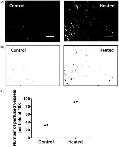 Figure 2. Tumour vascular perfusion is increased following systemic heating of mice bearing FaDu tumours (n = 2). Fluorescent liposomes were injected 2 h post-heating when body temperature has returned to homeostatic level. (A) Representative fluorescence micrographs (10×) showing perfusion of FaDu tumour vessel in unheated control and in heated mice, and (B) the corresponding binary images. (C) Plot of the number of perfused vessels in the tumours determined using NIH ImageJ particle analysis routine shows an increase in the number of perfused vessels in tumour from mice that were heated (average 92 in two tumours) and unheated control (average 33 in two tumours). Scale bar = 100 µm.