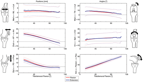 Figure 8. The six degrees of freedom of post-arthroplasty kinematics are shown relative to tibiofemoral flexion for both the flexion and extension phases (mean and standard deviation). The overall patterns are similar to the pre-arthroplasty patterns (Figure 6), but with shifts in the absolute values (see Figure 9). [Color version available online.]