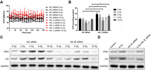 Figure 7 Effects of HK-II siRNA treatment on the TCA cycle in Tu212 cells treated with radiotherapy. (A) Oxygen consumption rate. (B) ATP content. (C) Expression of PDH and CS proteins in vitro. (D) Expression of PDH and CS proteins in xenograft tumors. (**p<0.01, ##p<0.01, and ^^compare in pair, ^compare in pairs).