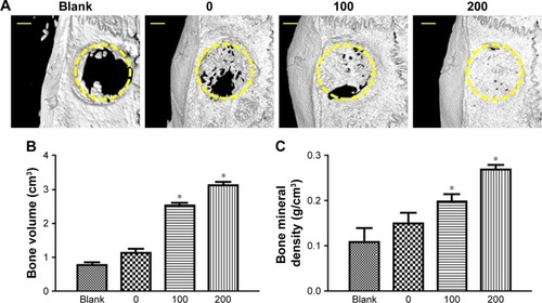 Figure 7 Evaluation of new bone formation in calvarial defects at 8 weeks post-implantation via µCT.Notes: (A) Representative µCT images of calvarial defects showing mineralized bone formation after treatment with no implant (blank), SCS/P scaffold (0), i/SCS/P containing 100 ng irisin (100), and i/SCS/P containing 200 ng irisin (200), respectively. The yellow circle indicates the original defect margin. Scale bar: 1 mm. Quantitative analysis of (B) the volume of the regenerated BV and (C) BMD. *P<0.05, compared with blank and 0 groups.Abbreviations: µCT, microcomputed tomography; SCS/P, silk/calcium silicate/sodium alginate/PVA; i/SCS/P, irisin-loaded silk/calcium silicate/sodium alginate/PVA; BV, bone volume; BMD, bone mineral density.