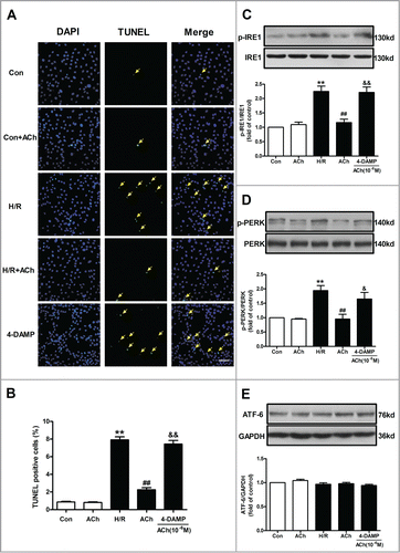 Figure 5. ACh inhibited PERK and IRE1 signaling pathways to protect HUVECs against H/R injury. (A and B) H/R-induced increase in TUNEL-positive cells was inhibited by ACh, 4-DAMP (10−6 M) abrogated the benefits of ACh in the context of H/R. Scale bar = 200 μm. The changes of p-IRE1/IRE1 (C), p-PERK/PERK (D) and ATF6 (E) expression were examined by Western blot. Open bar, normoxia; filled bar, H/R. The data expressed as mean ± SEM in each bar graph represent the average of 4 independent experiments. **P < 0.01 vs Con; ##P < 0.01 vs H/R; &P < 0.05 and &&P < 0.01 vs ACh-treated H/R group.