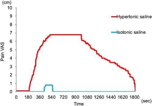 Figure 3 Example of experimental protocol for a subject. The pain VAS after isotonic saline (blue line) and hypertonic saline (red line) infusions are indicated respectively. Time 0 sec shows the beginning of saline infusion.