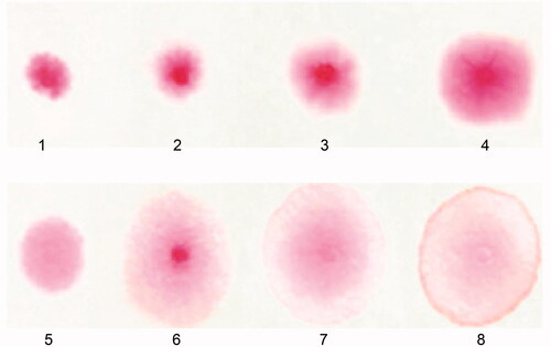 Figure 1. Staining patterns of urine Congo-red staining. According to the recommendations of the manufacturers numbers 1–4 are classified as a negative result and the numbers 5–8 as positive result.