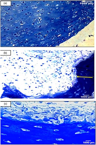 Figure 5. Toluidine blue staining examination (Toluidine blue x 400). Cartilage matrix and nuclei appear as deep violet. However, cytoplasm and other tissue elements are shown light blue. (a): A section in the articular cartilage of knee condyles of the control group showing normal thickness of the cartilage [toluidine blue X400] (b): The knee articular cartilage of the arthritic group showing a decrease in thickness of the cartilage [toluidine blue X400] (c): Section in the irisin-treated arthritic group showing knee condyles with a moderately increased thickness of the cartilage compared with that in the arthritic group [X400].